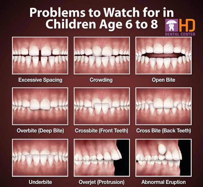 What is orthodontic treatment? - Nha Khoa Numberone