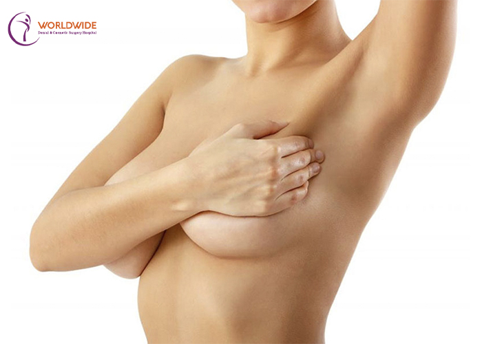 Breast lift (mastopexy)