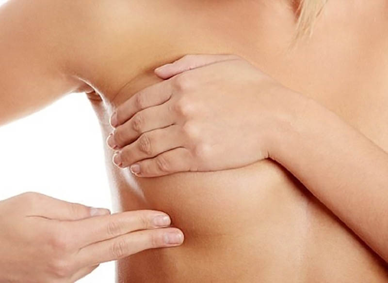 Ưu điểm của nâng ngực sa trễ
