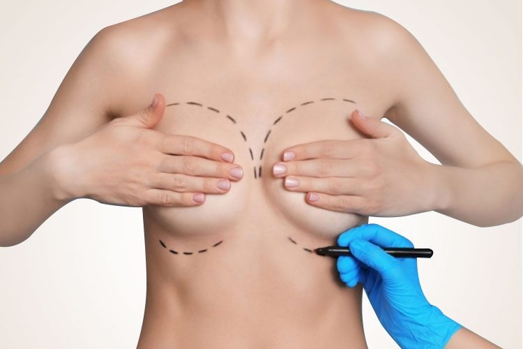 Bác sĩ tư vấn túi ngực và đường mổ phù hợp