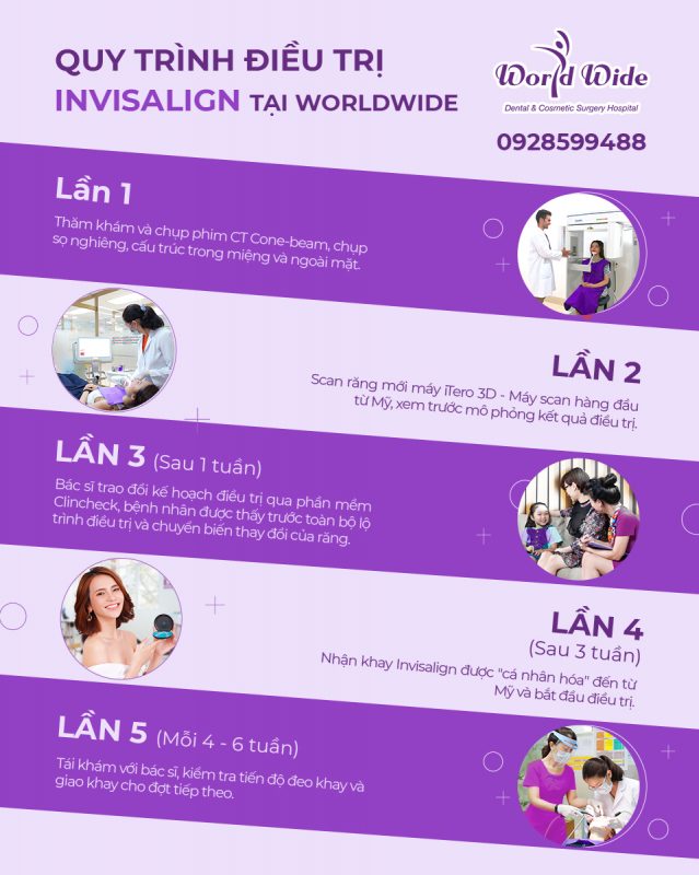 10 ĐIỀU BẠN CẦN BIẾT VỀ INVISALIGN