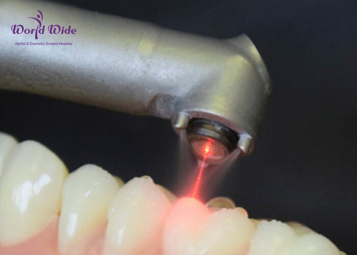 điều trị răng nhạy cảm bằng laser lightwalker