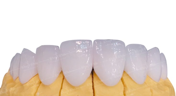 vật liệu răng sứ
