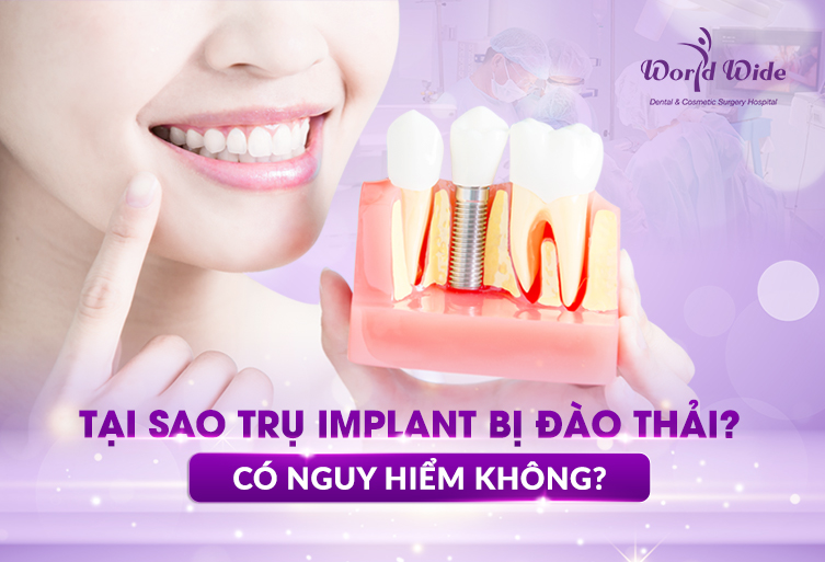 trụ implant bị đào thải