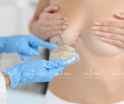 nâng ngực bằng vật liệu độn nhân tạo là một trong những phương pháp nâng ngực phổ biến
