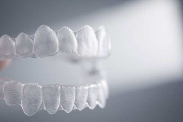 Đeo hàm duy trì sau khi niềng răng có tác dụng gì?