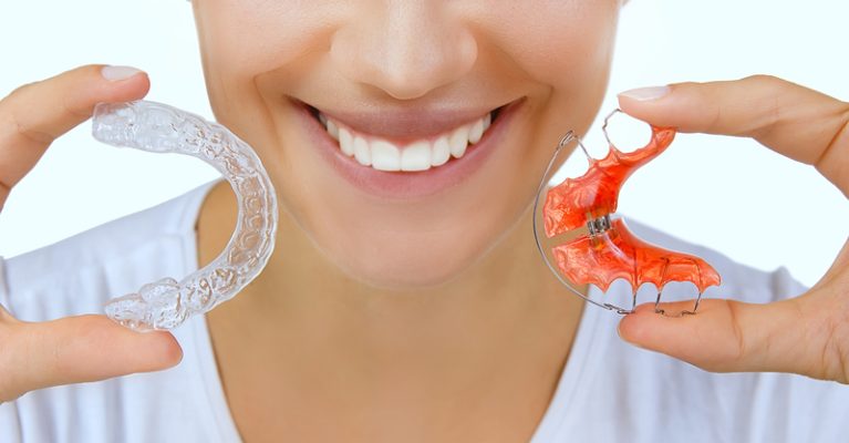Đeo hàm duy trì khi niềng răng có những loại nào?