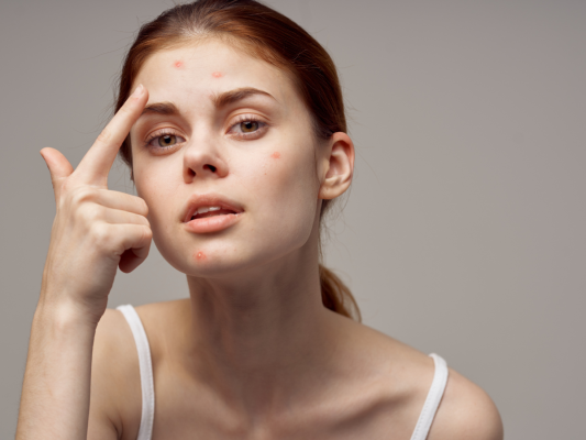 mụn, liệu trình trị mụn
