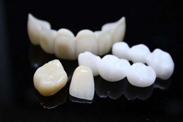 Các dòng răng sứ: răng toàn sứ