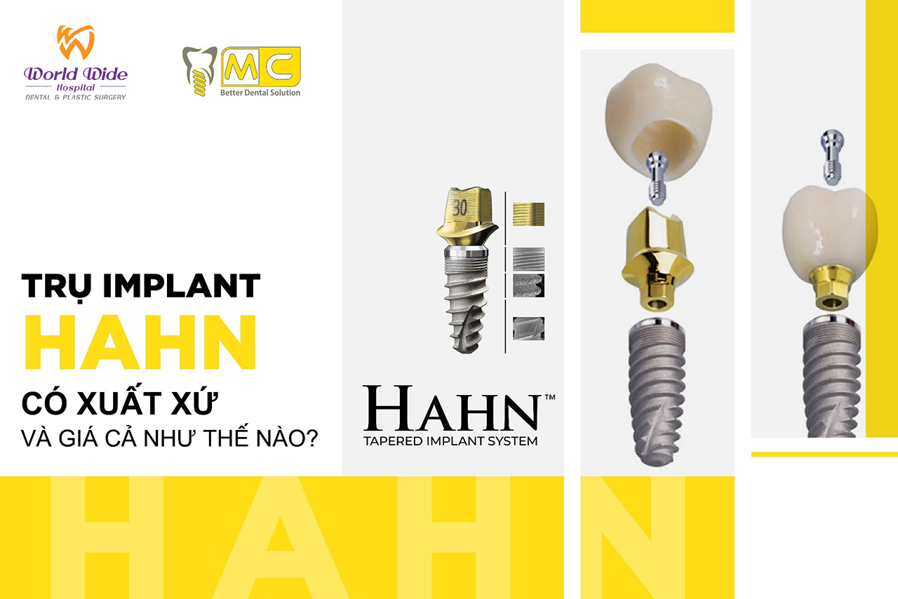 trụ implant hahn có xuất xứ và giá cả như thế nào