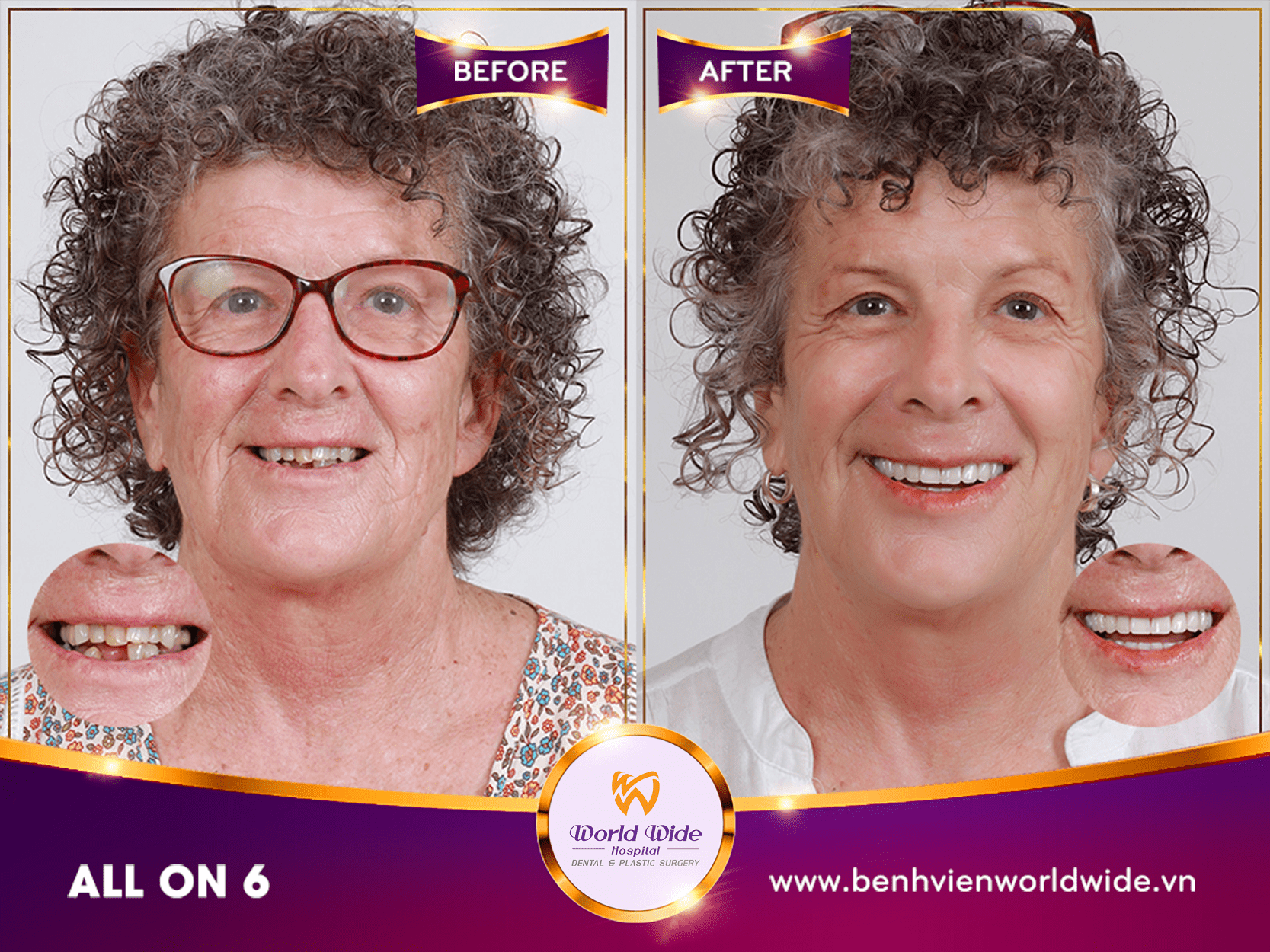 all on 6 tại worldwide