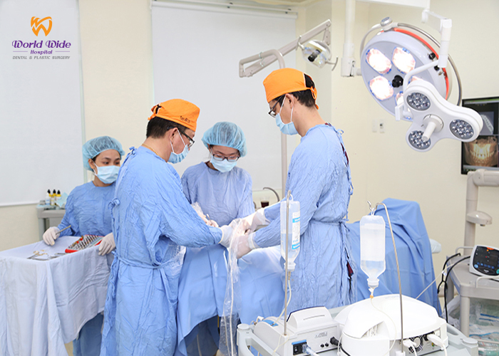 BAD BREATH implant dich vu