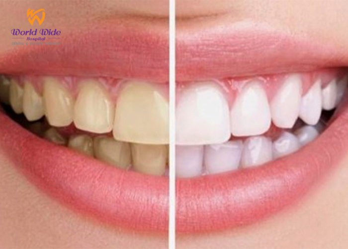 BAD BREATH BAD BREATH?