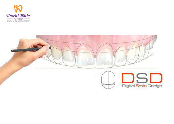 BAD BREATH SMILE DESIGN