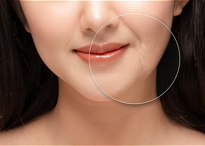 Tummy Tuck - Worldwide Hospital PUFFY EYES, DARK CIRCLES REMOVAL