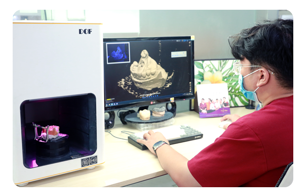 Taking digital impression & Fabrication of the crowns