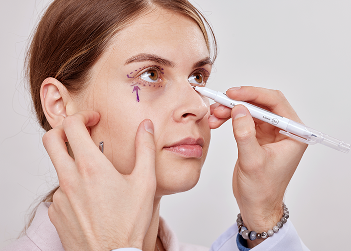 EYELID ELITE 5.0 PUFFY EYES, DARK CIRCLES REMOVAL