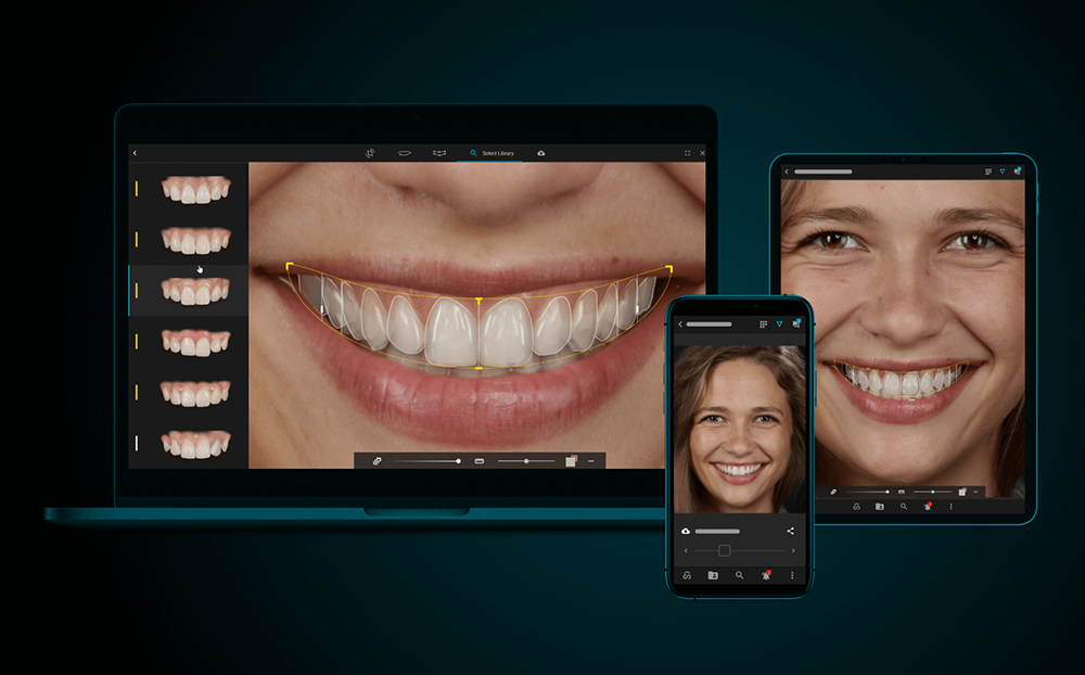 DENTAL CROWNS, VENEERS & BRIDGES DENTAL CROWNS