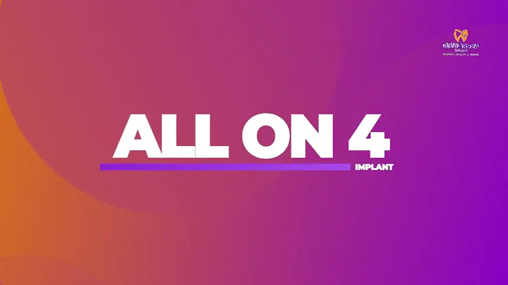 ALL-ON-4 / ALL-ON-6 thumbnail-videoallin