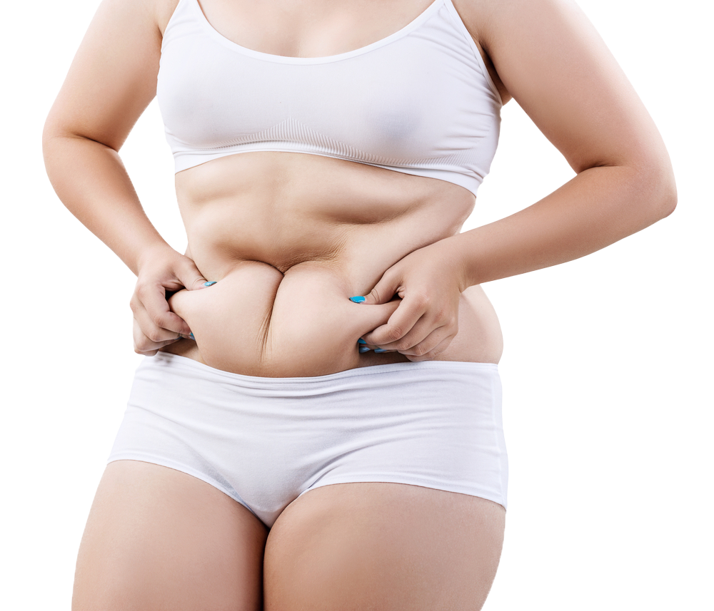 hút mỡ tạo hình thành bụng