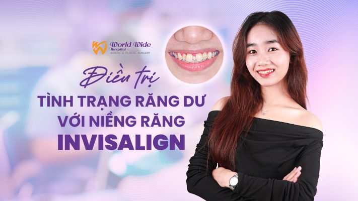invisalign