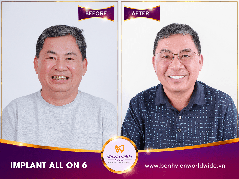 Dịch vụ răng hàm mặt rang-su-tham-my