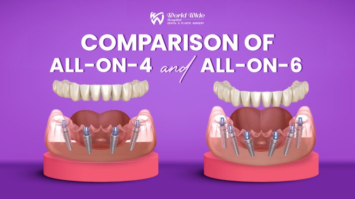 ht smile porcelain crowns