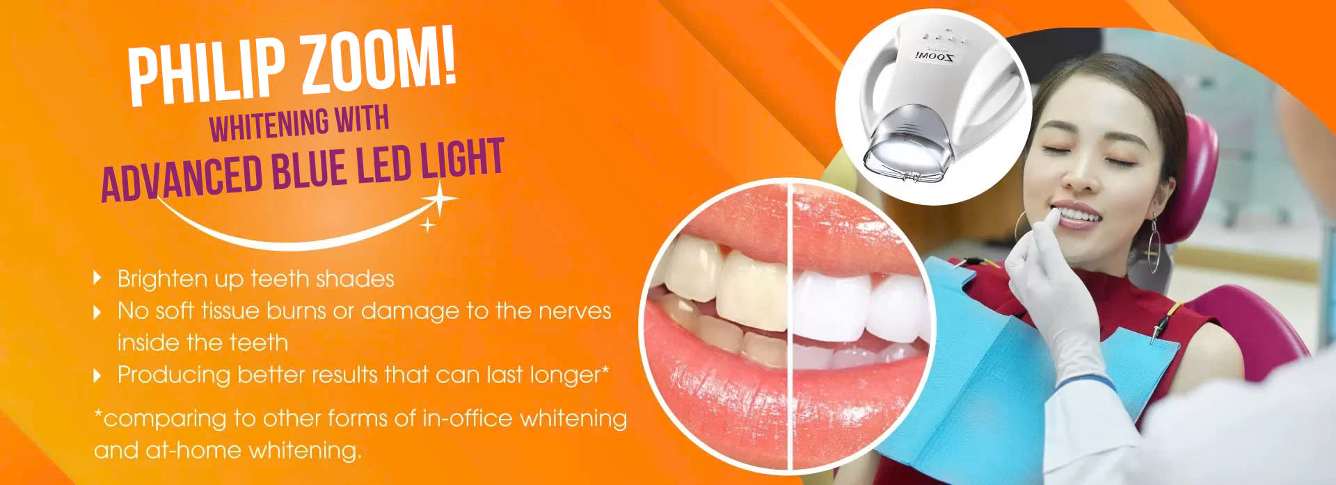 Teeth Whitening teeth whitening