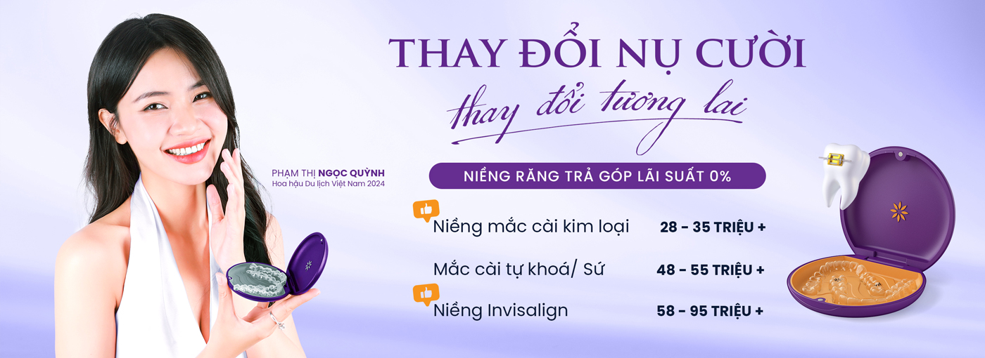 Các loại mắc cài niềng răng mắc cài niềng răng