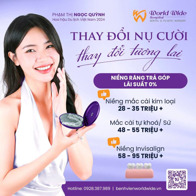 Các loại mắc cài niềng răng mắc cài niềng răng