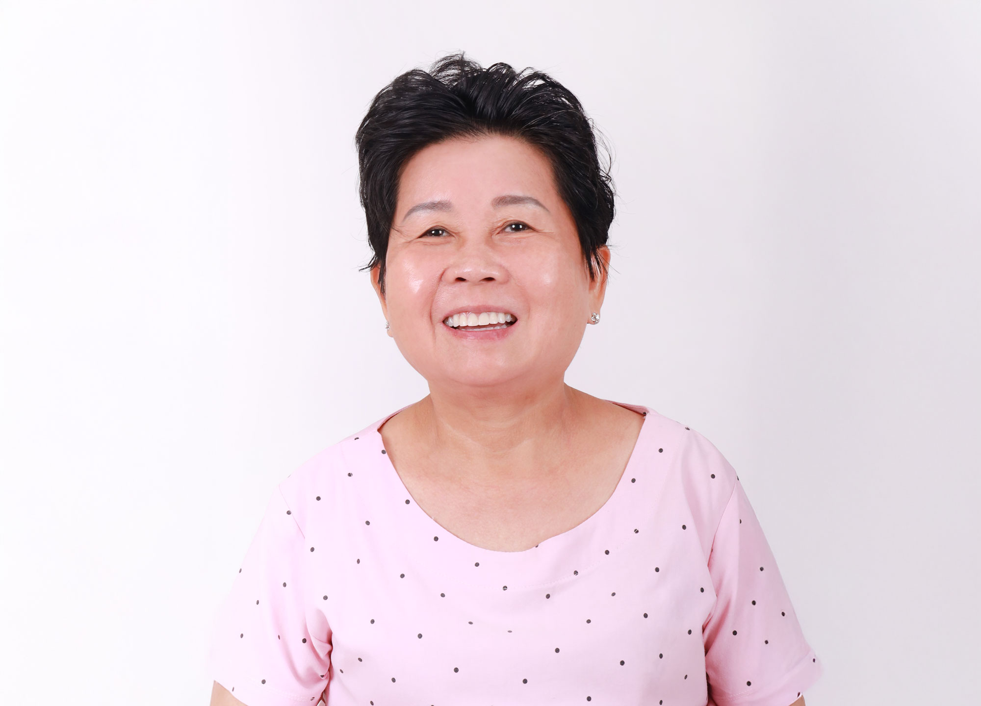 Trồng nhiều răng implant cùng lúc có được không? Giải pháp hiệu quả cho người mất răng toàn hàm
