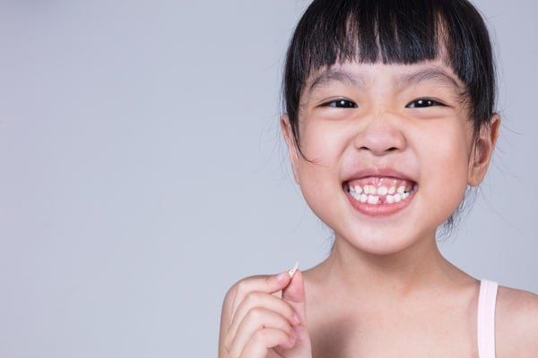 Niềng răng sớm cho trẻ: Những điều cha mẹ cần biết khi trẻ từ 6 đến 9 tuổi