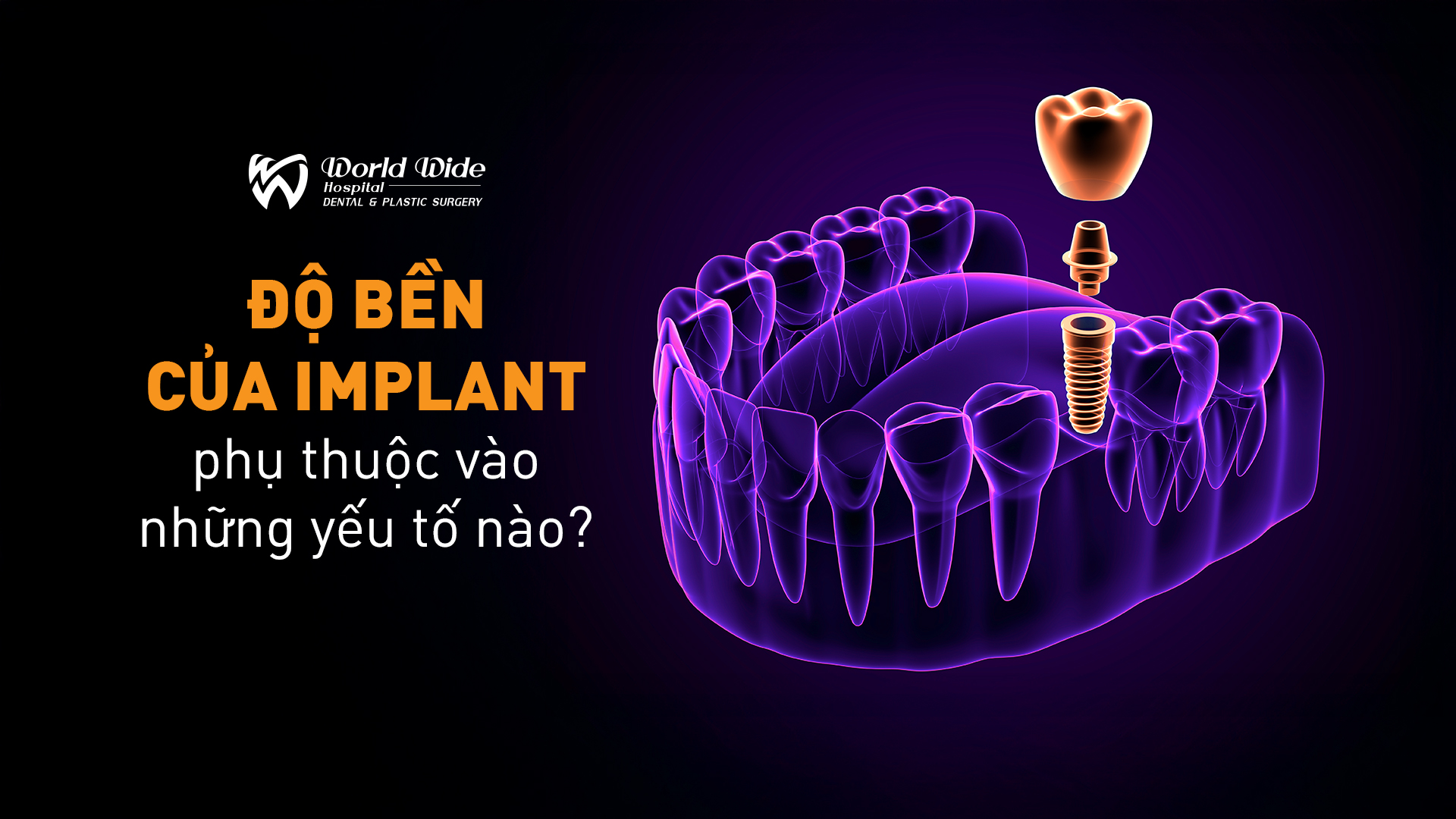 Độ bền của implant phụ thuộc vào những yếu tố nào?