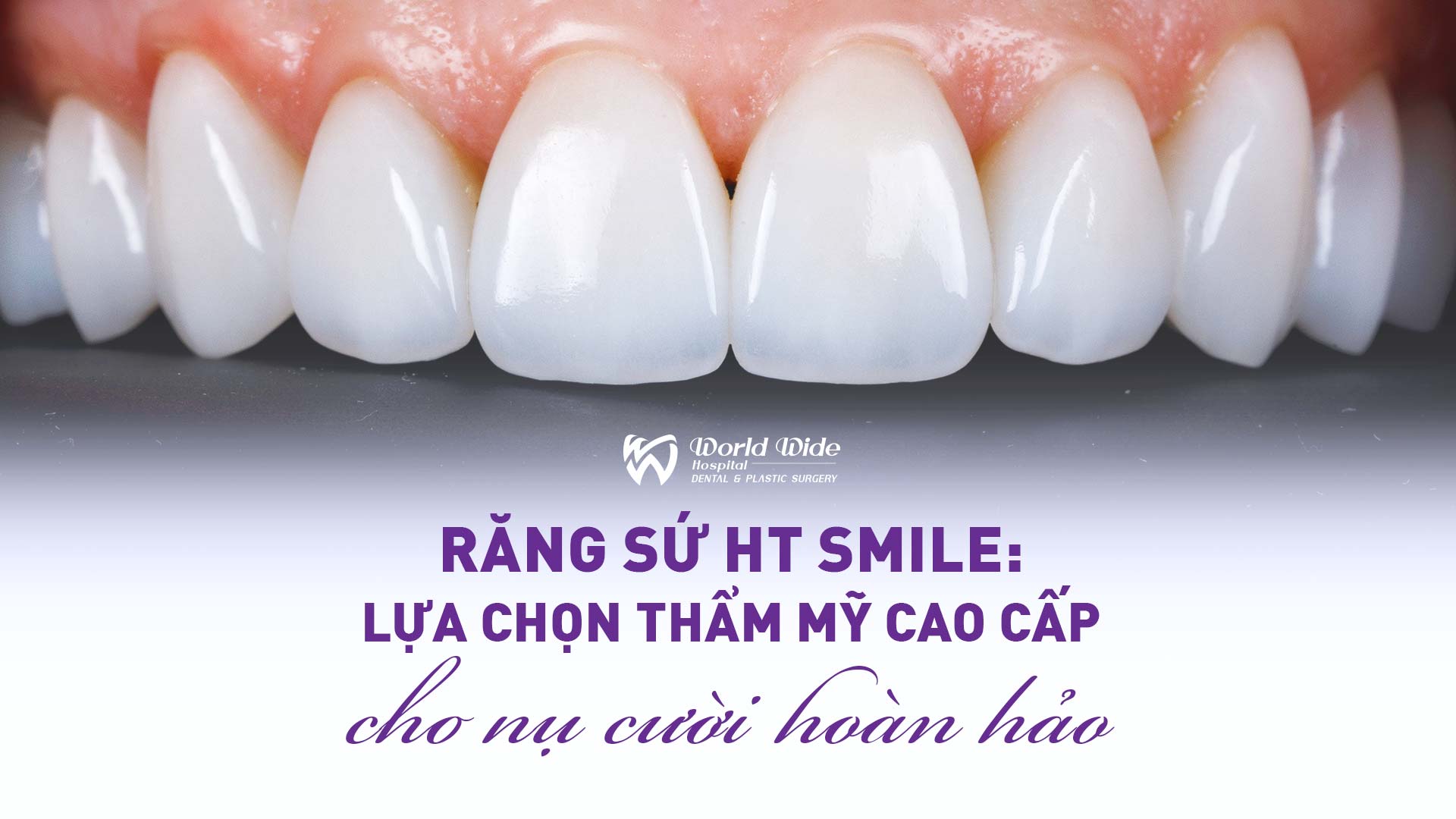 RĂNG SỨ HT SMILE: LỰA CHỌN THẨM MỸ CAO CẤP CHO NỤ CƯỜI HOÀN HẢO