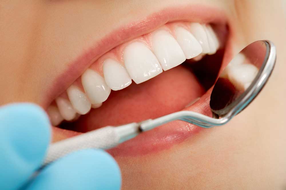 Niềng răng xong có bị tái xô lệch không? Cách duy trì kết quả lâu dài