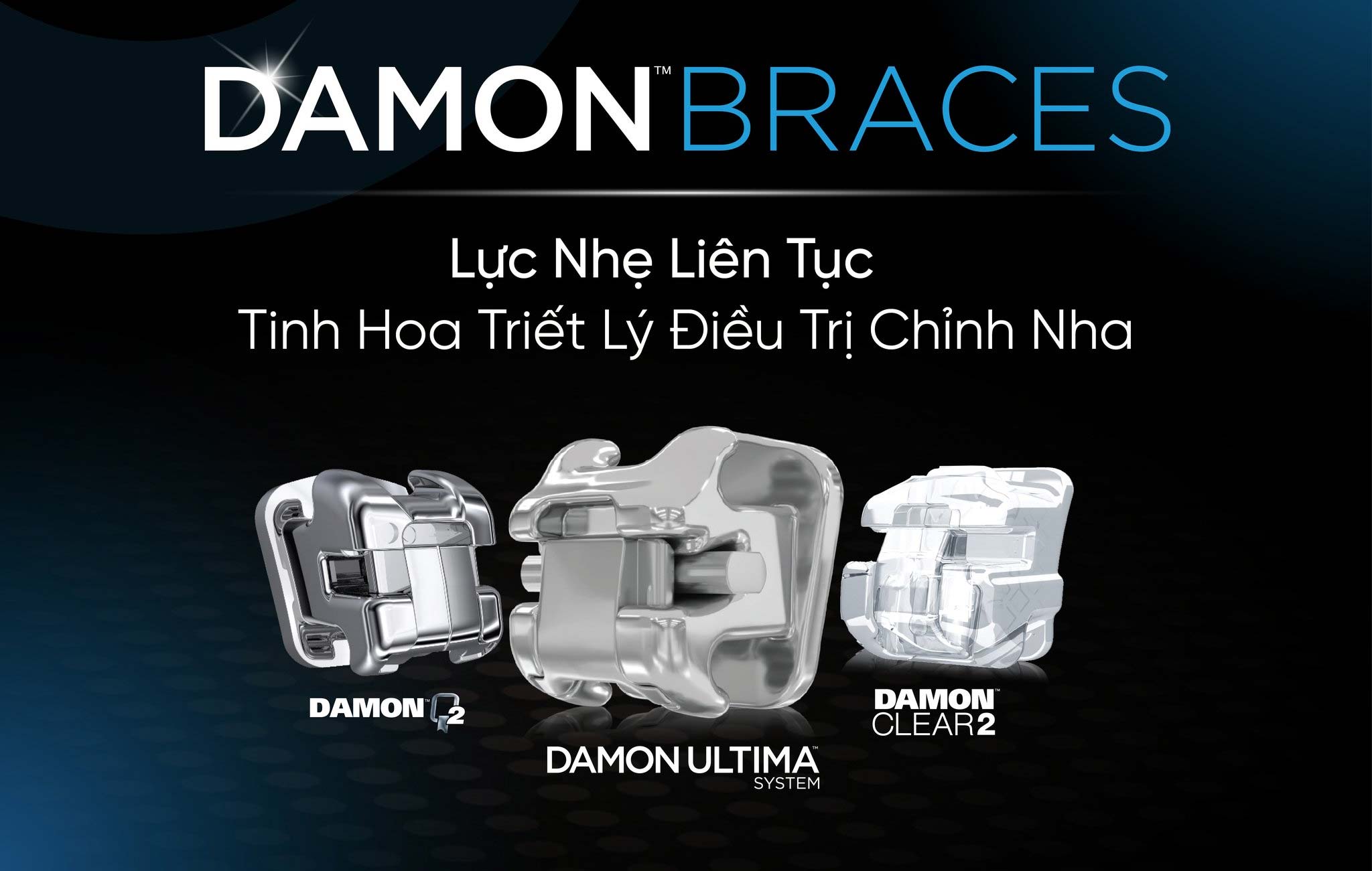 CẤU TẠO HỆ THỐNG MẮC CÀI DAMON: VÌ SAO LẠI ÍT ĐAU VÀ NHẸ LỰC?