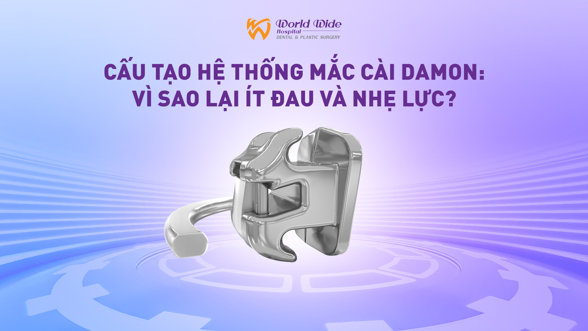 CẤU TẠO HỆ THỐNG MẮC CÀI DAMON: VÌ SAO LẠI ÍT ĐAU VÀ NHẸ LỰC?