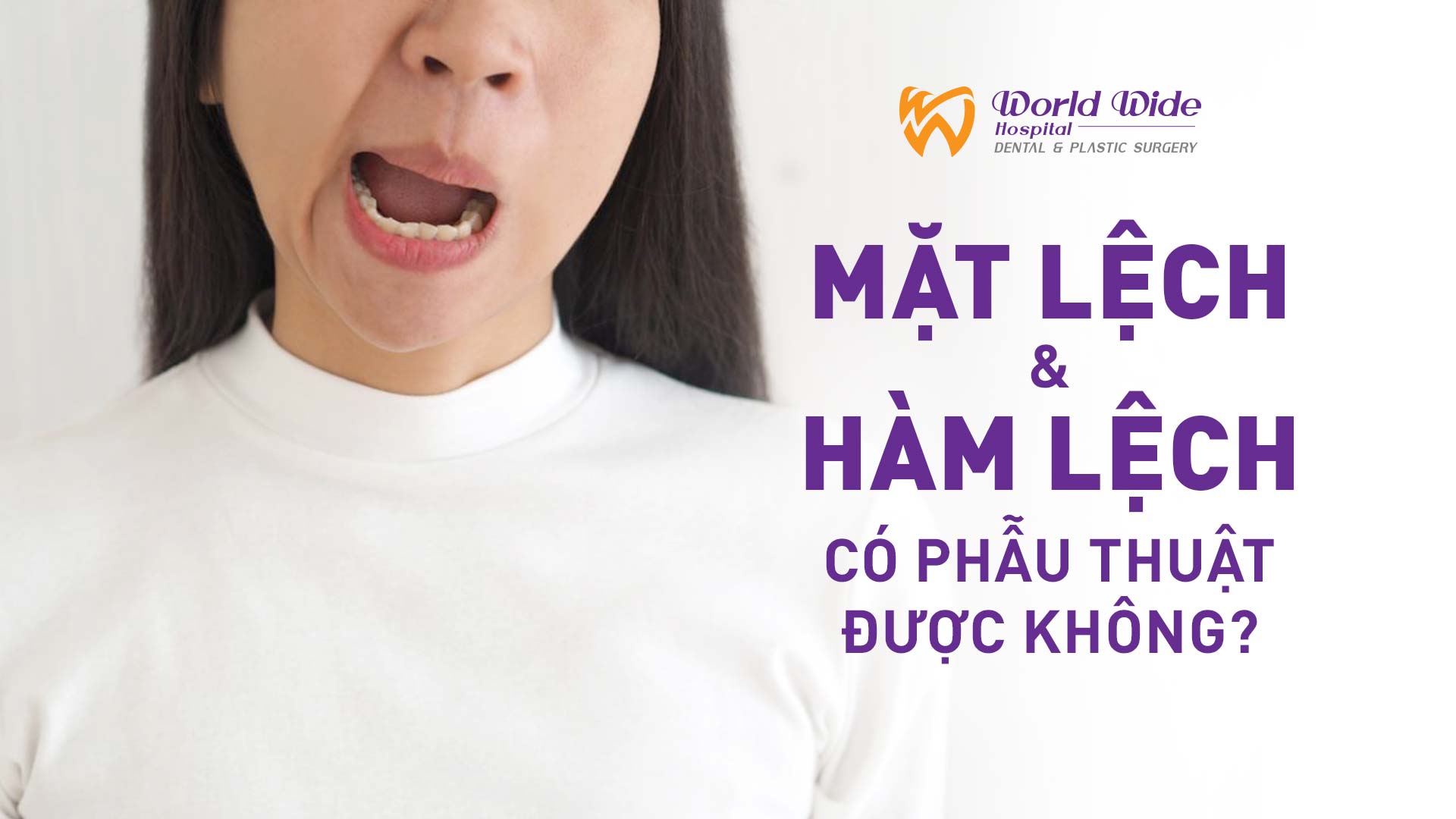 MẶT LỆCH, HÀM LỆCH CÓ PHẪU THUẬT ĐƯỢC KHÔNG?