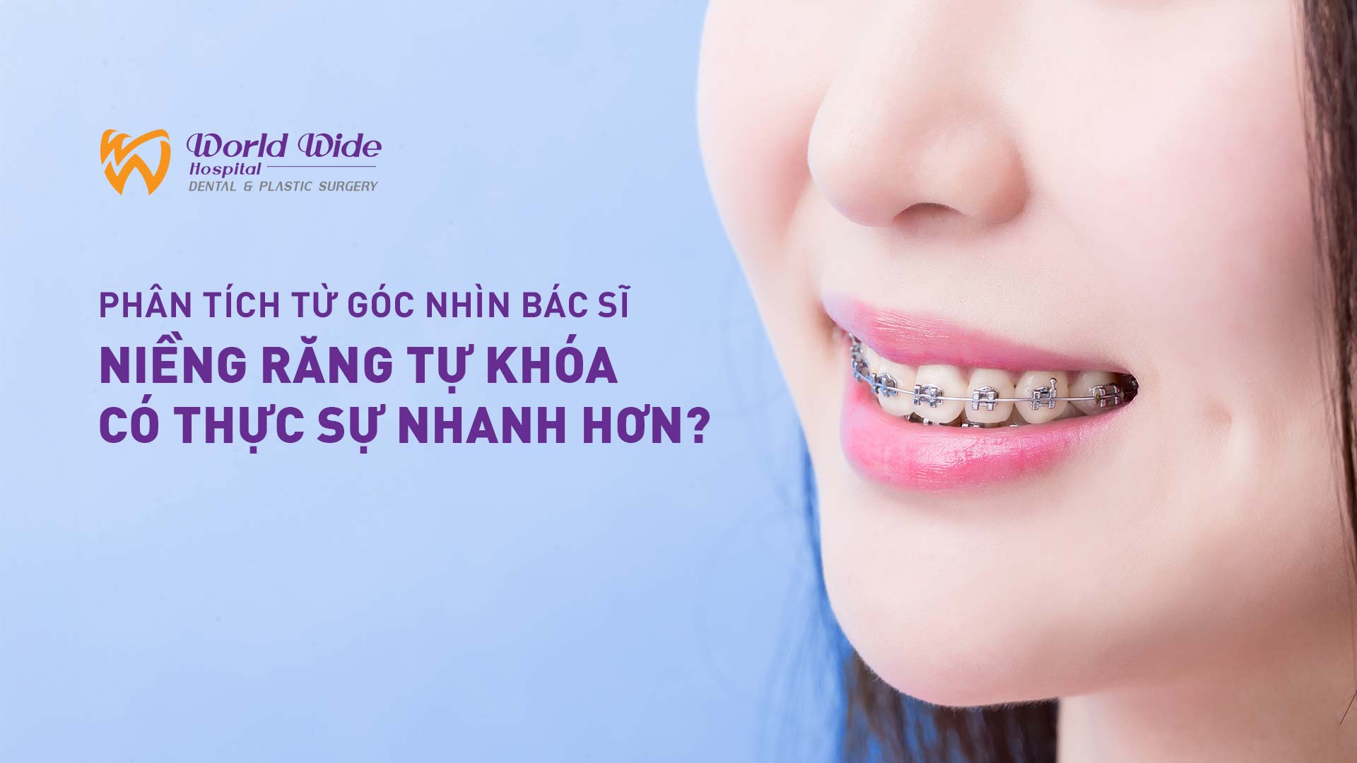 NIỀNG RĂNG TỰ KHÓA CÓ THỰC SỰ NHANH HƠN? PHÂN TÍCH TỪ GÓC NHÌN BÁC SĨ