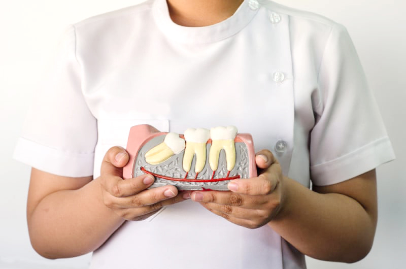 SO SÁNH NHỔ RĂNG KHÔN BẰNG PIEZOTOME VÀ PHƯƠNG PHÁP TRUYỀN THỐNG: ĐÂU LÀ LỰA CHỌN TỐI ƯU?