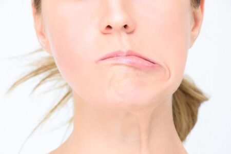 MẶT LỆCH, HÀM LỆCH CÓ PHẪU THUẬT ĐƯỢC KHÔNG?