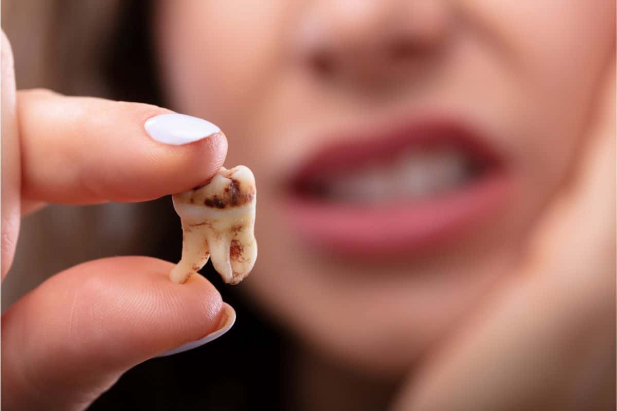 RĂNG KHÔN GẦN DÂY THẦN KINH – CÓ NÊN NHỔ KHÔNG? GIẢI ĐÁP TỪ GÓC NHÌN CHUYÊN MÔN