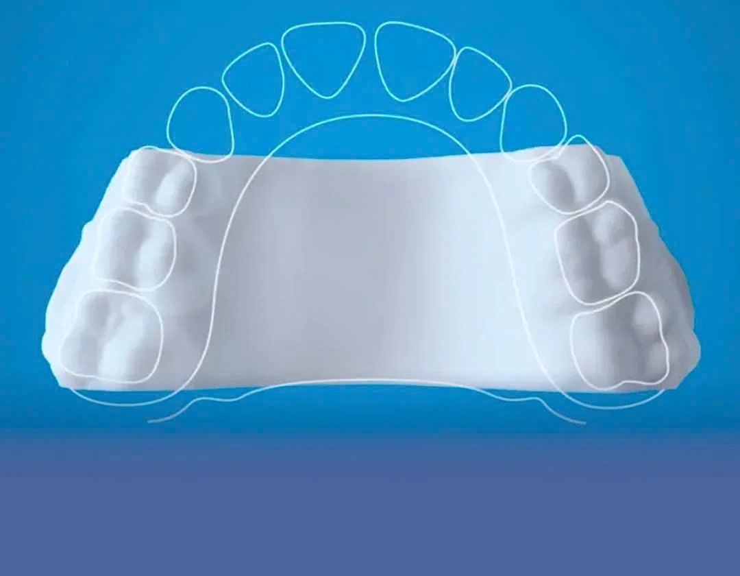 Chỉnh Nha Sớm – Chỉnh Nha Tăng Trưởng: Hành Trình Xây Nụ Cười Khỏe Đẹp Từ Tuổi Thơ