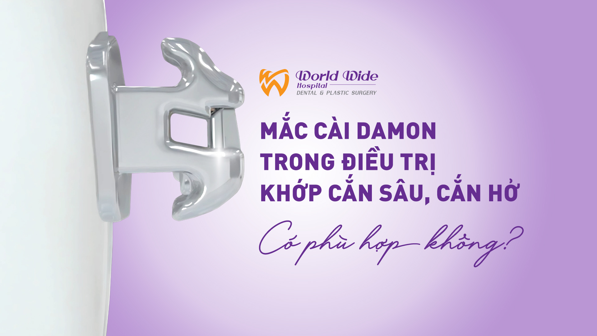 MẮC CÀI DAMON TRONG ĐIỀU TRỊ KHỚP CẮN SÂU, CẮN HỞ – CÓ PHÙ HỢP KHÔNG?