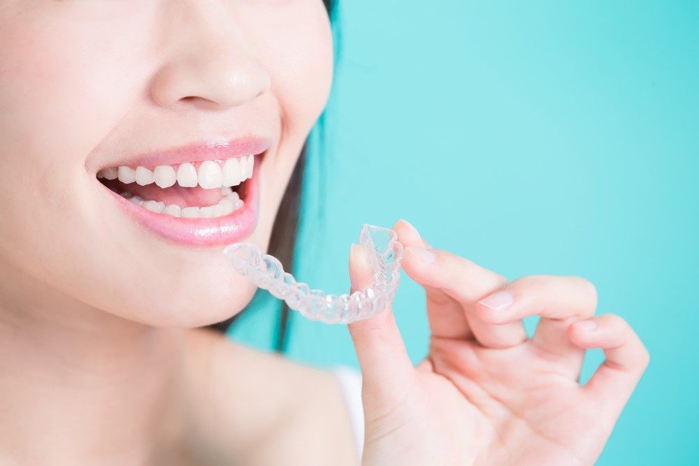 Niềng răng mắc cài và Invisalign: Nên chọn loại nào cho từng độ tuổi?