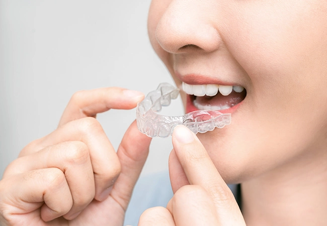 Niềng răng tựu trường: Thời điểm lý tưởng để bắt đầu hành trình thay đổi nụ cười