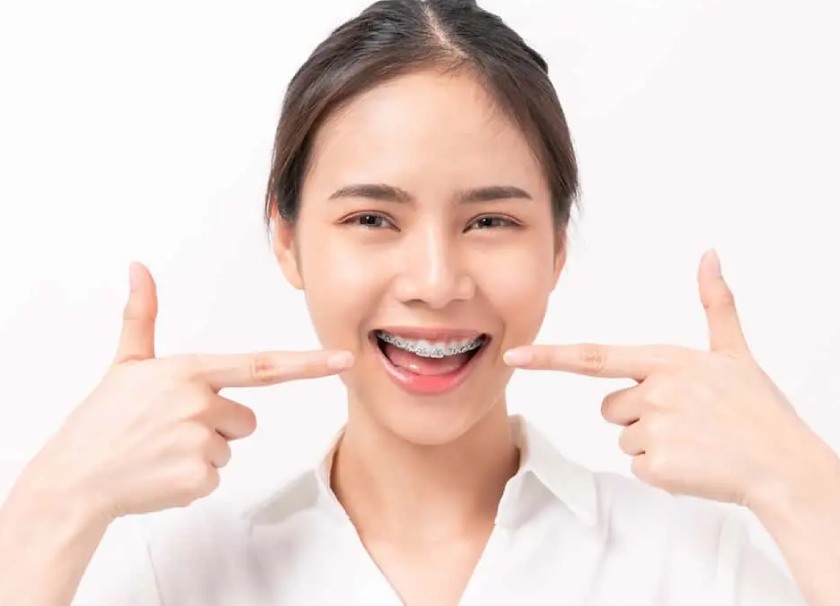 Niềng răng mắc cài và Invisalign: Nên chọn loại nào cho từng độ tuổi?