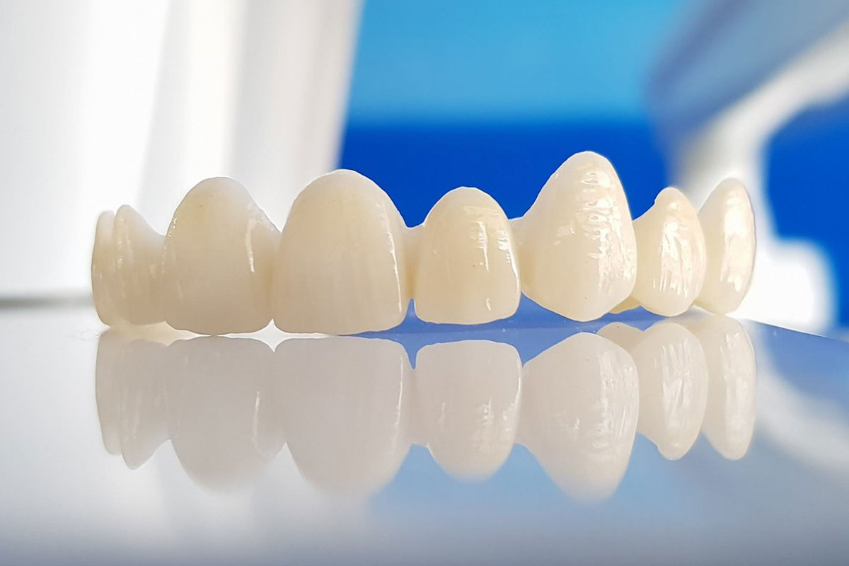 NÊN CHỌN RĂNG SỨ ZIRCONIA HAY HT SMILE? KHÁC NHAU ĐIỂM NÀO?