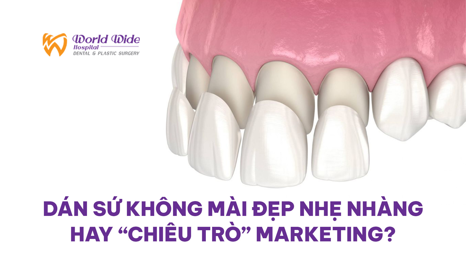 DÁN SỨ KHÔNG MÀI – ĐẸP NHẸ NHÀNG HAY “CHIÊU TRÒ” MARKETING?