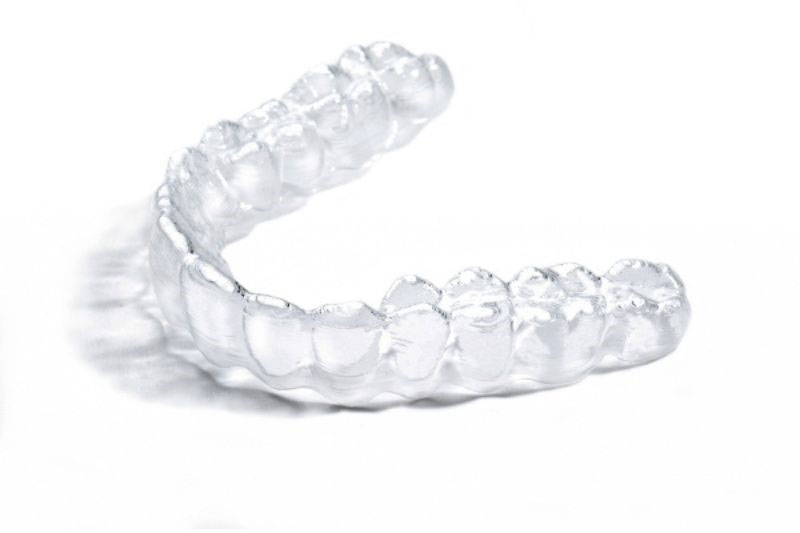 NIỀNG RĂNG XONG LÀ PHẢI ĐEO HÀM DUY TRÌ TRỌN ĐỜI? ĐÚNG HAY SAI?